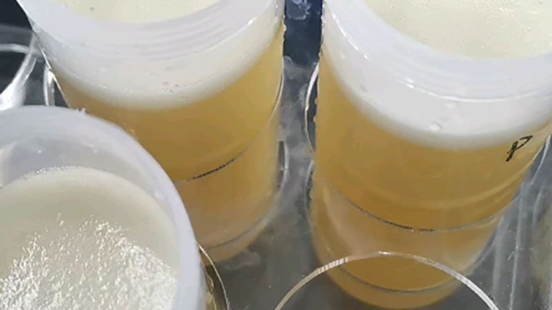 Fermentation Broth